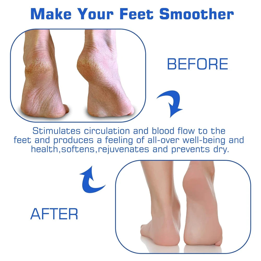 Silicone Exfoliating Shower Foot Scrubber